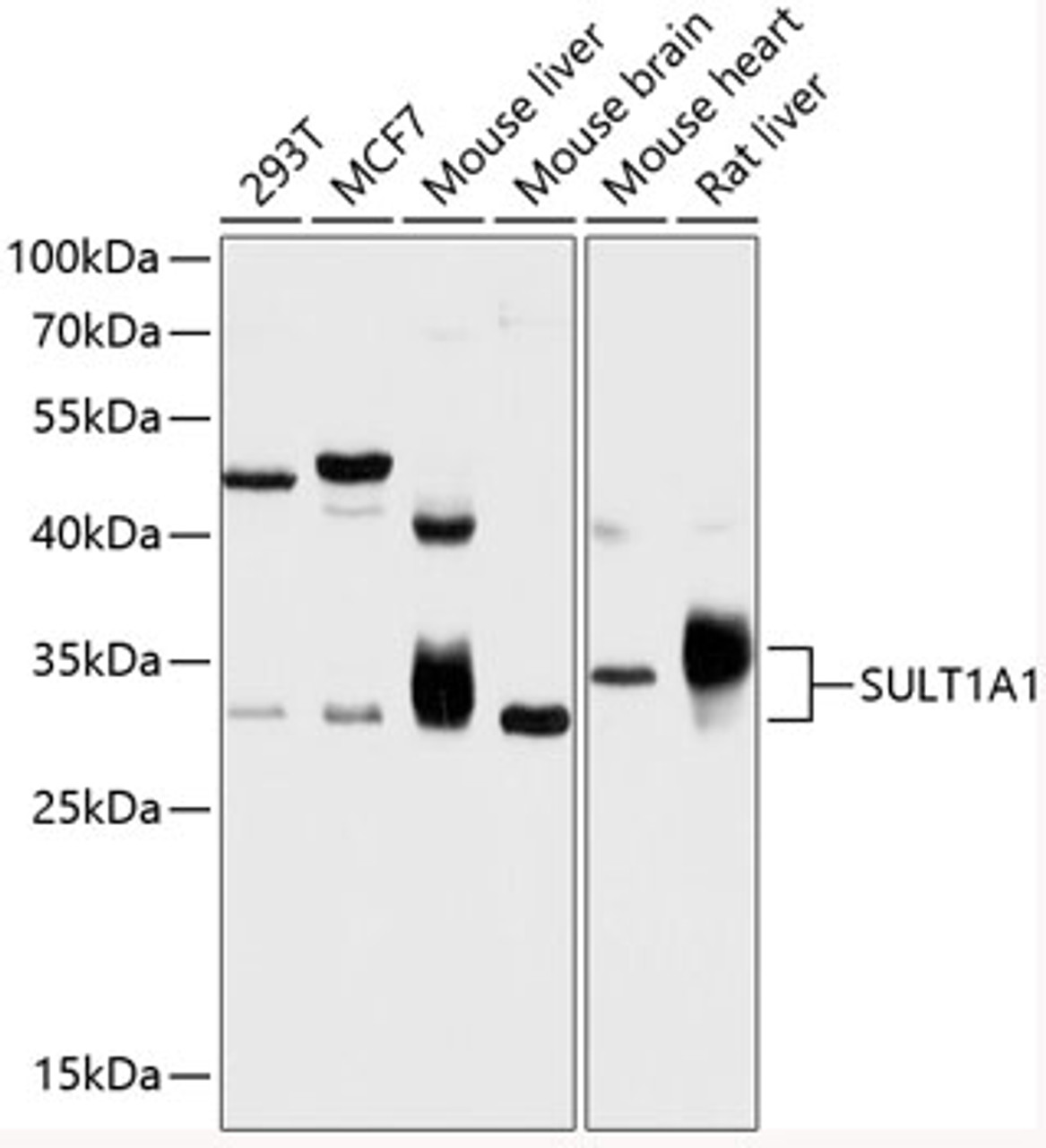 Western blot analysis of extracts of various cell lines, using SULT1A1 antibody (14-480) at 1:1000 dilution.<br/>Secondary antibody: HRP Goat Anti-Rabbit IgG (H+L) at 1:10000 dilution.<br/>Lysates/proteins: 25ug per lane.<br/>Blocking buffer: 3% nonfat dry milk in TBST.<br/>Detection: ECL Basic Kit.<br/>Exposure time: 10s.
