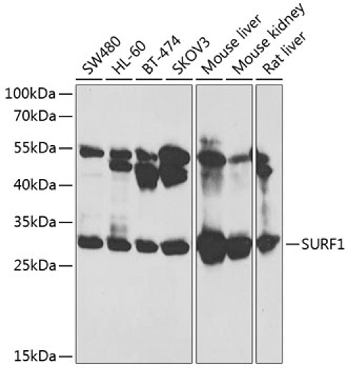 Western blot analysis of extracts of various cell lines, using SURF1 antibody (14-481) at 1:1000 dilution.<br/>Secondary antibody: HRP Goat Anti-Rabbit IgG (H+L) at 1:10000 dilution.<br/>Lysates/proteins: 25ug per lane.<br/>Blocking buffer: 3% nonfat dry milk in TBST.<br/>Detection: ECL Basic Kit.<br/>Exposure time: 3s.