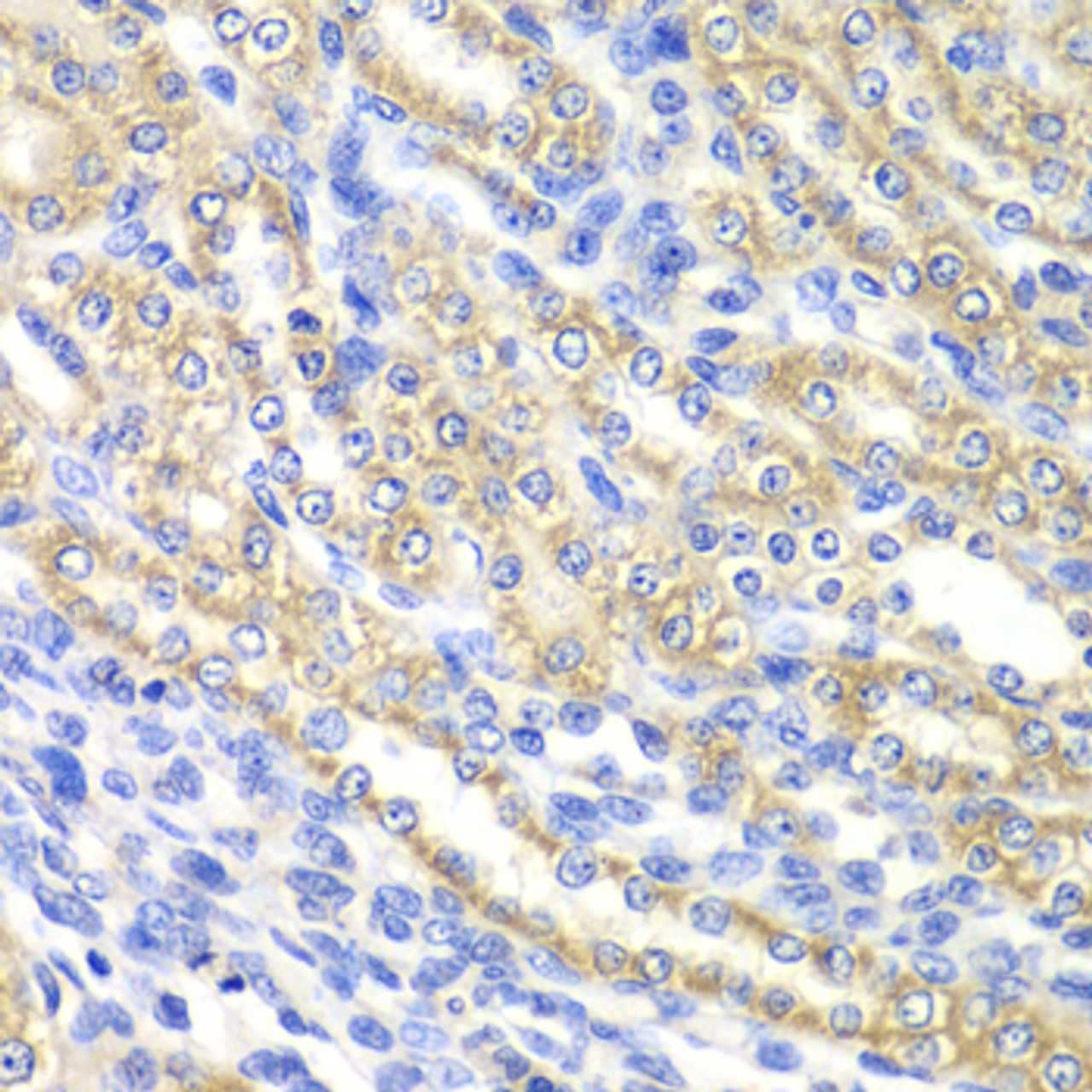 Immunohistochemistry of paraffin-embedded rat kidney using SURF1 antibody (14-481) at dilution of 1:100 (40x lens) .