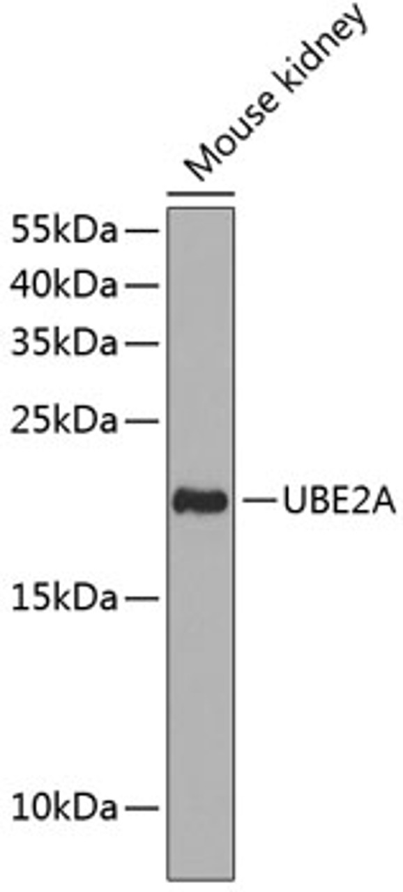 Western blot analysis of extracts of mouse kidney, using UBE2A antibody (14-485) at 1:1000 dilution.<br/>Secondary antibody: HRP Goat Anti-Rabbit IgG (H+L) at 1:10000 dilution.<br/>Lysates/proteins: 25ug per lane.<br/>Blocking buffer: 3% nonfat dry milk in TBST.<br/>Detection: ECL Basic Kit.<br/>Exposure time: 90s.