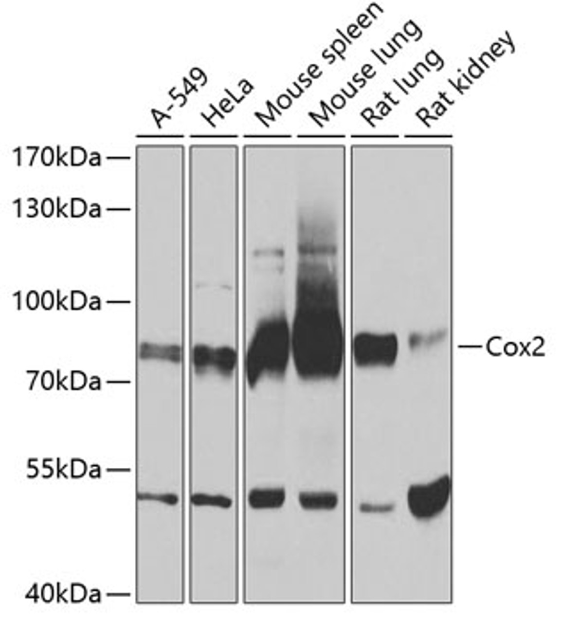 Western blot analysis of extracts of various cell lines, using Cox2 antibody (14-486) at 1:1000 dilution.<br/>Secondary antibody: HRP Goat Anti-Rabbit IgG (H+L) at 1:10000 dilution.<br/>Lysates/proteins: 25ug per lane.<br/>Blocking buffer: 3% nonfat dry milk in TBST.<br/>Detection: ECL Basic Kit.<br/>Exposure time: 3s.