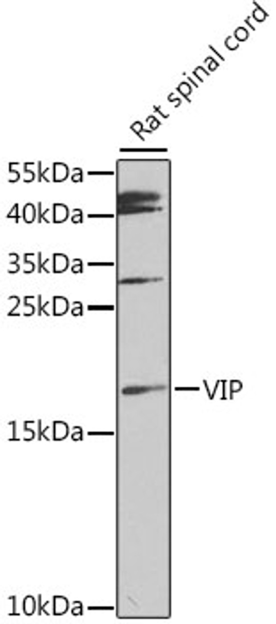 Western blot analysis of extracts of rat spinal cord, using VIP antibody (14-487) at 1:1000 dilution.<br/>Secondary antibody: HRP Goat Anti-Rabbit IgG (H+L) at 1:10000 dilution.<br/>Lysates/proteins: 25ug per lane.<br/>Blocking buffer: 3% nonfat dry milk in TBST.<br/>Detection: ECL Enhanced Kit.<br/>Exposure time: 90s.