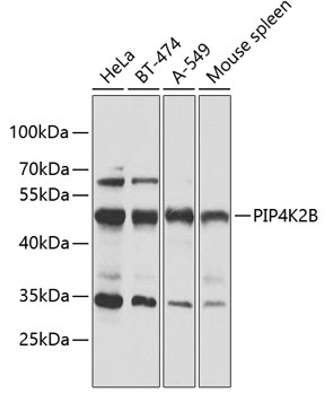 Western blot analysis of extracts of various cell lines, using PIP4K2B antibody (14-489) at 1:1000 dilution.<br/>Secondary antibody: HRP Goat Anti-Rabbit IgG (H+L) at 1:10000 dilution.<br/>Lysates/proteins: 25ug per lane.<br/>Blocking buffer: 3% nonfat dry milk in TBST.<br/>Detection: ECL Basic Kit.<br/>Exposure time: 30s.