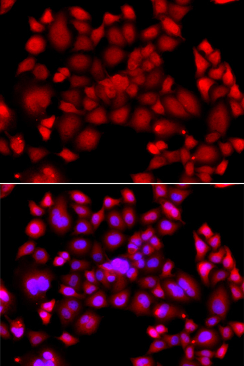 Immunofluorescence analysis of A549 cells using PIP4K2B antibody (14-489) . Blue: DAPI for nuclear staining.