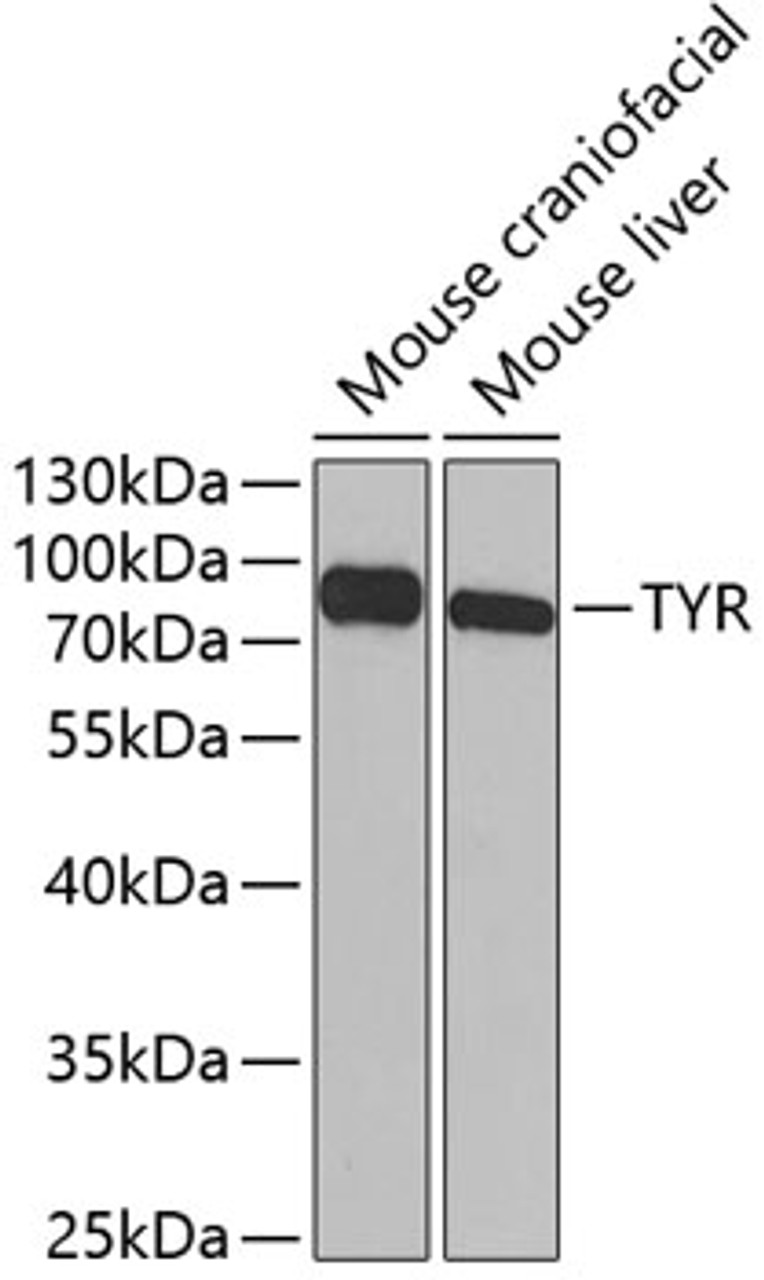 Western blot analysis of extracts of various cell lines, using TYR antibody (14-493) at 1:1000 dilution.<br/>Secondary antibody: HRP Goat Anti-Rabbit IgG (H+L) at 1:10000 dilution.<br/>Lysates/proteins: 25ug per lane.<br/>Blocking buffer: 3% nonfat dry milk in TBST.