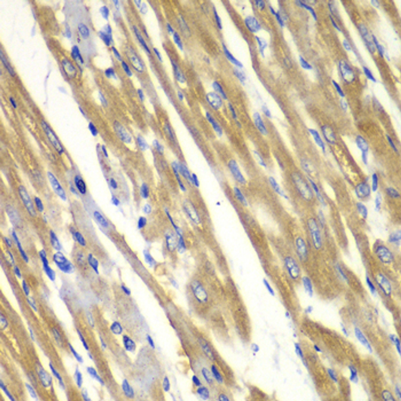 Immunohistochemistry of paraffin-embedded rat heart using TYR antibody (14-493) at dilution of 1:100 (40x lens) .