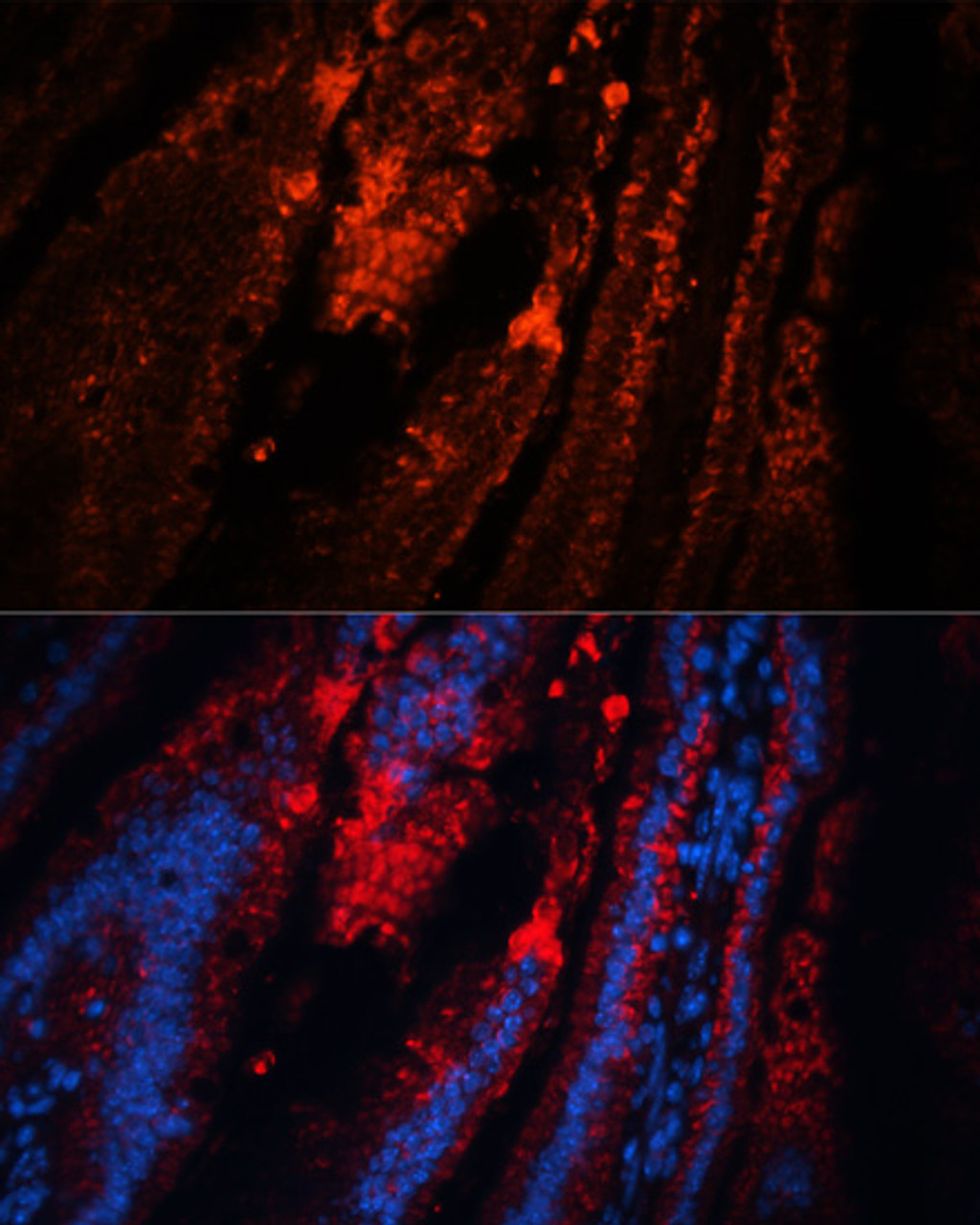 Immunofluorescence analysis of mouse intestine using TRPA1 antibody (14-496) at dilution of 1:100. Blue: DAPI for nuclear staining.