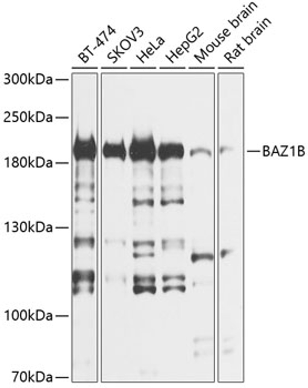 Western blot analysis of extracts of various cell lines, using BAZ1B antibody (14-497) at 1:1000 dilution.<br/>Secondary antibody: HRP Goat Anti-Rabbit IgG (H+L) at 1:10000 dilution.<br/>Lysates/proteins: 25ug per lane.<br/>Blocking buffer: 3% nonfat dry milk in TBST.<br/>Detection: ECL Basic Kit.<br/>Exposure time: 5s.