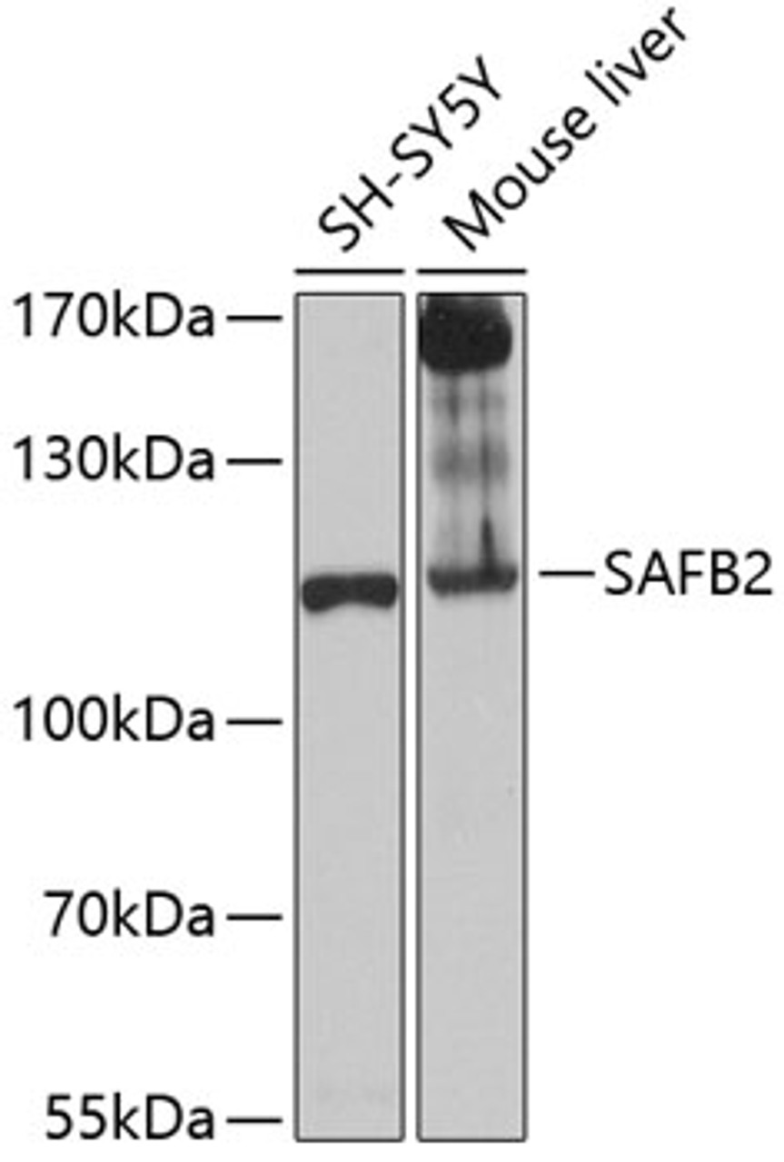 Western blot analysis of extracts of various cell lines, using SAFB2 antibody (14-501) at 1:1000 dilution.<br/>Secondary antibody: HRP Goat Anti-Rabbit IgG (H+L) at 1:10000 dilution.<br/>Lysates/proteins: 25ug per lane.<br/>Blocking buffer: 3% nonfat dry milk in TBST.<br/>Detection: ECL Basic Kit.<br/>Exposure time: 30s.