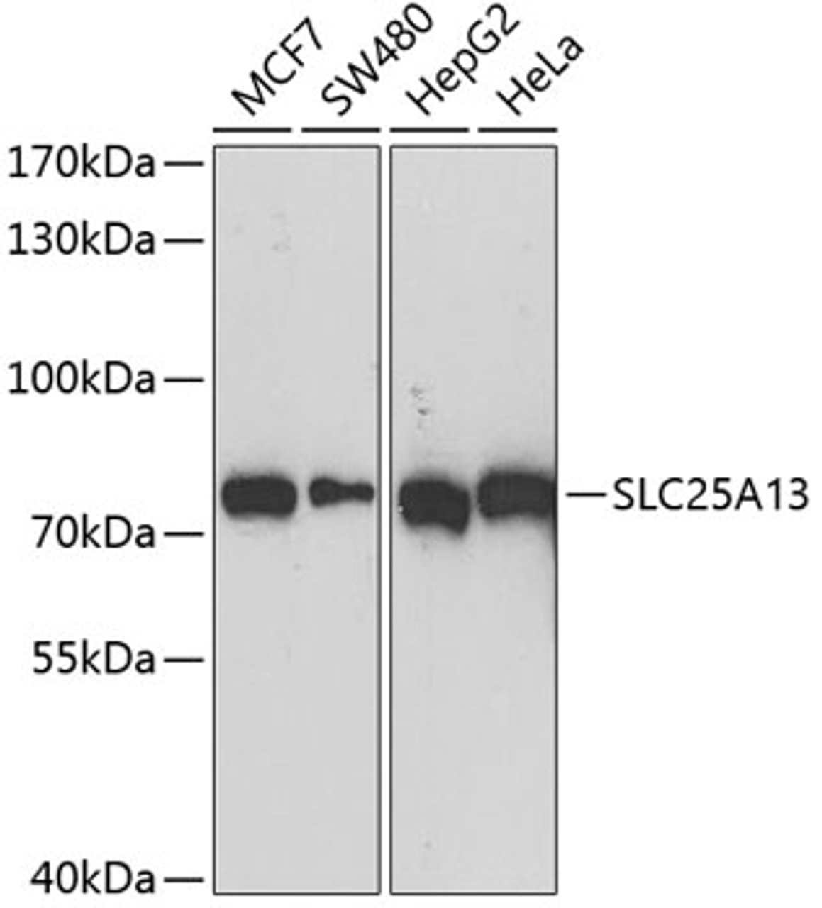 Western blot analysis of extracts of various cell lines, using SLC25A13 antibody (14-506) at 1:1000 dilution.<br/>Secondary antibody: HRP Goat Anti-Rabbit IgG (H+L) at 1:10000 dilution.<br/>Lysates/proteins: 25ug per lane.<br/>Blocking buffer: 3% nonfat dry milk in TBST.<br/>Detection: ECL Basic Kit.<br/>Exposure time: 90s.