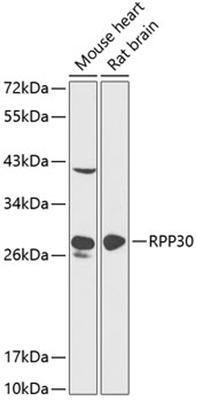 Western blot analysis of extracts of various cell lines, using RPP30 antibody (14-509) at 1:1000 dilution.<br/>Secondary antibody: HRP Goat Anti-Rabbit IgG (H+L) at 1:10000 dilution.<br/>Lysates/proteins: 25ug per lane.<br/>Blocking buffer: 3% nonfat dry milk in TBST.<br/>Detection: ECL Enhanced Kit.<br/>Exposure time: 90s.
