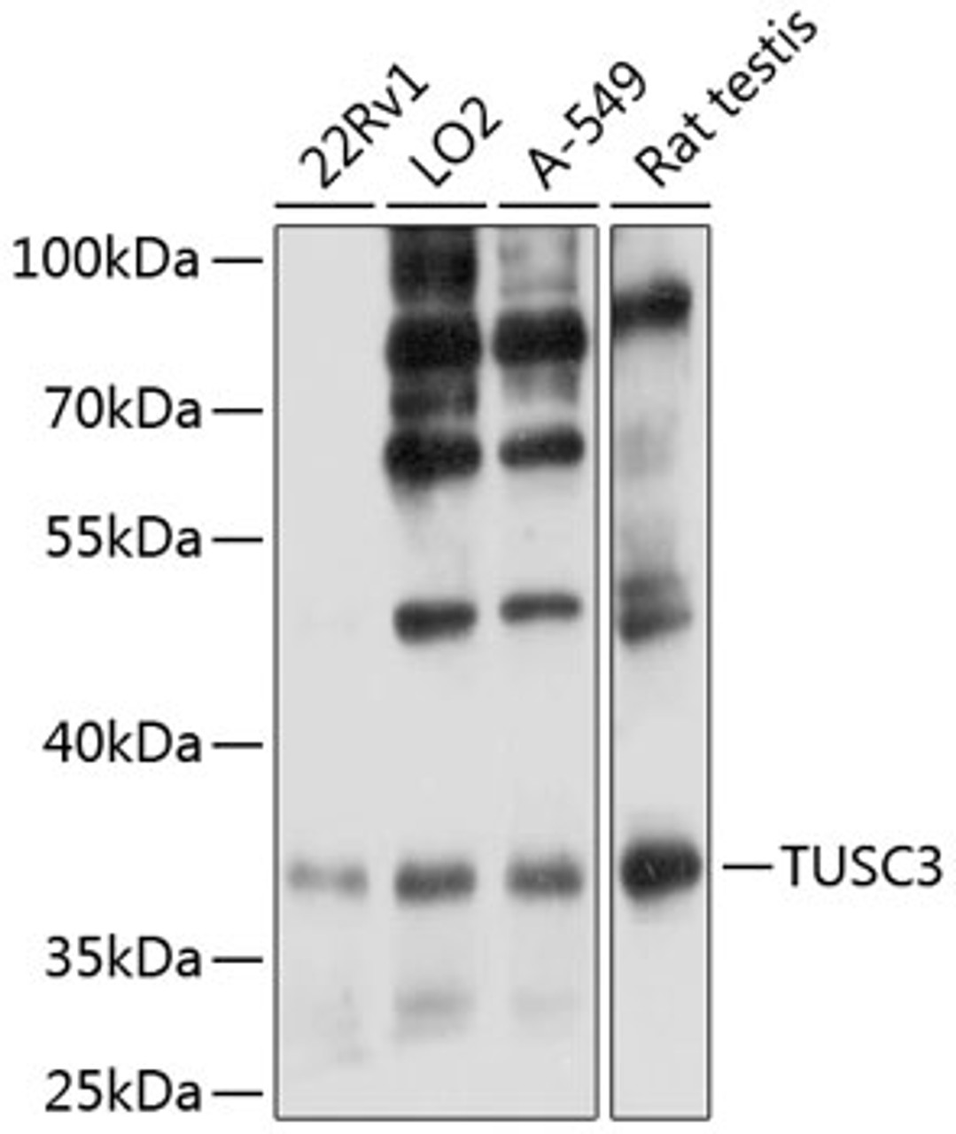 Western blot analysis of extracts of various cell lines, using TUSC3 antibody (14-516) at 1:3000 dilution._Secondary antibody: HRP Goat Anti-Rabbit IgG (H+L) at 1:10000 dilution._Lysates/proteins: 25ug per lane._Blocking buffer: 3% nonfat dry milk in TBST._Detection: ECL Enhanced Kit._Exposure time: 10s.