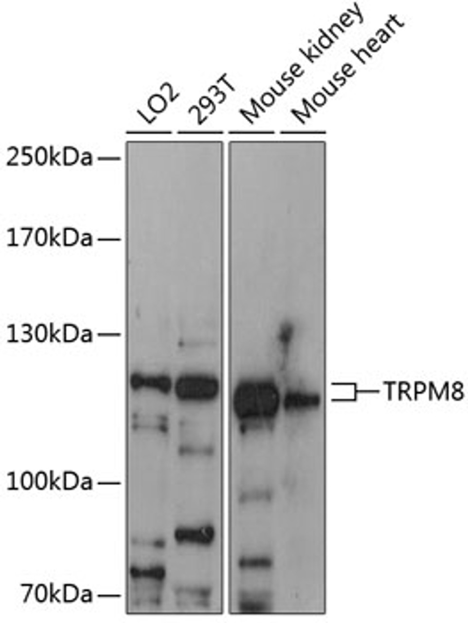 Western blot analysis of extracts of various cell lines, using TRPM8 antibody (14-517) at 1:3000 dilution.<br/>Secondary antibody: HRP Goat Anti-Rabbit IgG (H+L) at 1:10000 dilution.<br/>Lysates/proteins: 25ug per lane.<br/>Blocking buffer: 3% nonfat dry milk in TBST.<br/>Detection: ECL Enhanced Kit.<br/>Exposure time: 60s.