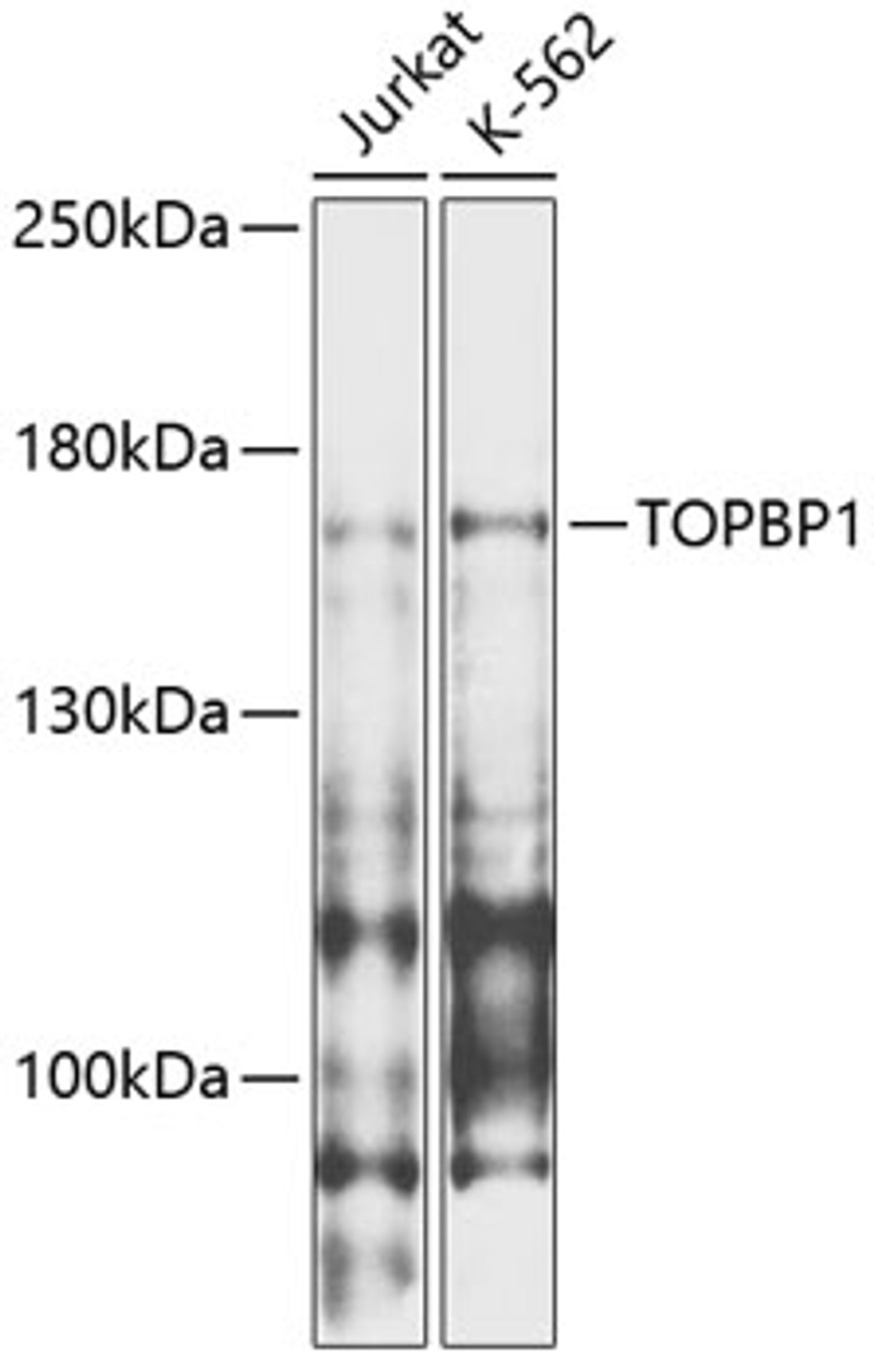Western blot analysis of extracts of various cell lines, using TOPBP1 antibody (14-518) at 1:1000 dilution.<br/>Secondary antibody: HRP Goat Anti-Rabbit IgG (H+L) at 1:10000 dilution.<br/>Lysates/proteins: 25ug per lane.<br/>Blocking buffer: 3% nonfat dry milk in TBST.<br/>Detection: ECL Enhanced Kit.<br/>Exposure time: 30s.