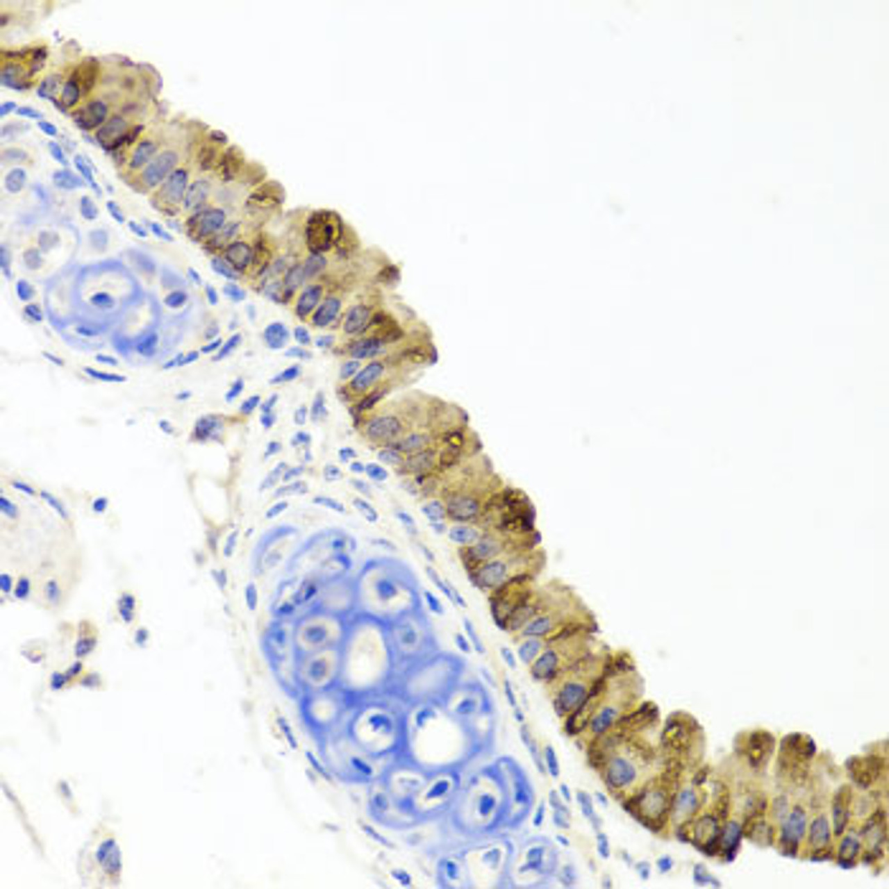 Immunohistochemistry of paraffin-embedded mouse lung using TOPBP1 antibody (14-518) at dilution of 1:100 (40x lens) .