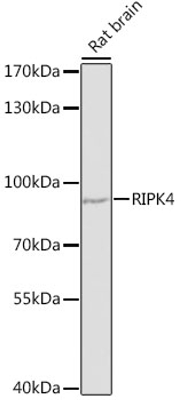 Western blot analysis of extracts of rat brain, using RIPK4 antibody (14-522) at 1:1000 dilution.<br/>Secondary antibody: HRP Goat Anti-Rabbit IgG (H+L) at 1:10000 dilution.<br/>Lysates/proteins: 25ug per lane.<br/>Blocking buffer: 3% nonfat dry milk in TBST.<br/>Detection: ECL Enhanced Kit.<br/>Exposure time: 90s.