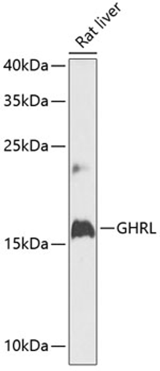 Western blot analysis of extracts of rat liver, using GHRL antibody (14-523) at 1:1000 dilution.<br/>Secondary antibody: HRP Goat Anti-Rabbit IgG (H+L) at 1:10000 dilution.<br/>Lysates/proteins: 25ug per lane.<br/>Blocking buffer: 3% nonfat dry milk in TBST.<br/>Detection: ECL Enhanced Kit.<br/>Exposure time: 90s.