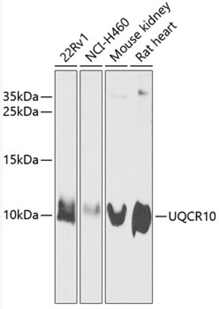 Western blot analysis of extracts of various cell lines, using UQCR10 antibody (14-526) at 1:1000 dilution.<br/>Secondary antibody: HRP Goat Anti-Rabbit IgG (H+L) at 1:10000 dilution.<br/>Lysates/proteins: 25ug per lane.<br/>Blocking buffer: 3% nonfat dry milk in TBST.<br/>Detection: ECL Enhanced Kit.<br/>Exposure time: 30s.