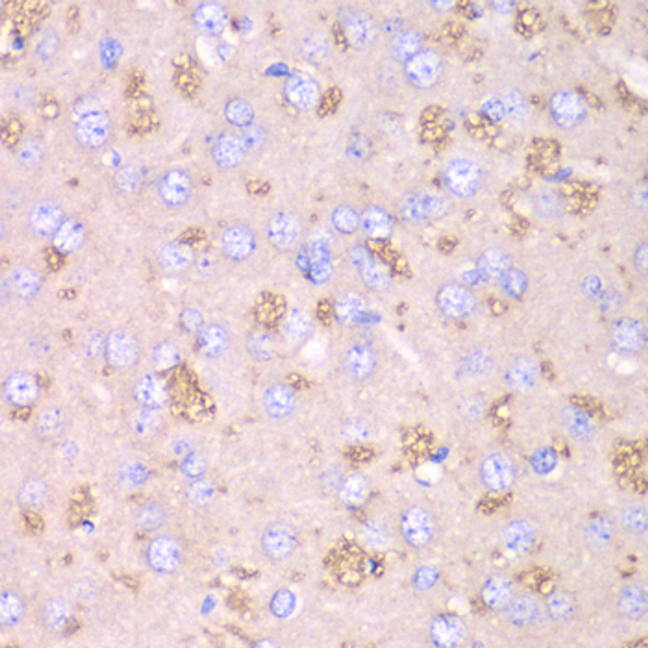 Immunohistochemistry of paraffin-embedded rat brain using TXN2 antibody (14-528) at dilution of 1:100 (40x lens) .