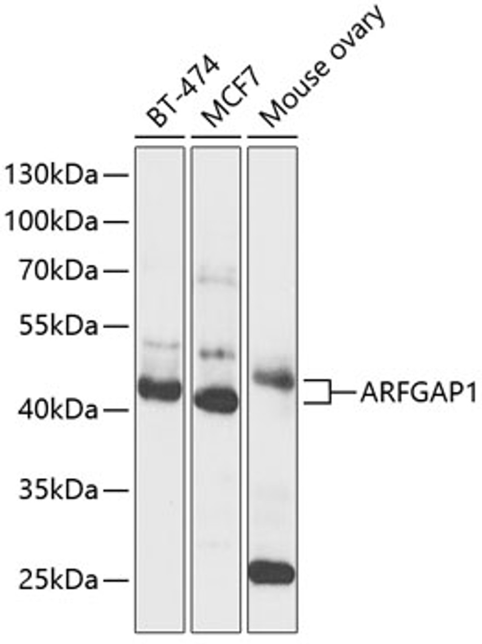 Western blot analysis of extracts of various cell lines, using ARFGAP1 antibody (14-531) at 1:1000 dilution.<br/>Secondary antibody: HRP Goat Anti-Rabbit IgG (H+L) at 1:10000 dilution.<br/>Lysates/proteins: 25ug per lane.<br/>Blocking buffer: 3% nonfat dry milk in TBST.<br/>Detection: ECL Basic Kit.<br/>Exposure time: 3s.