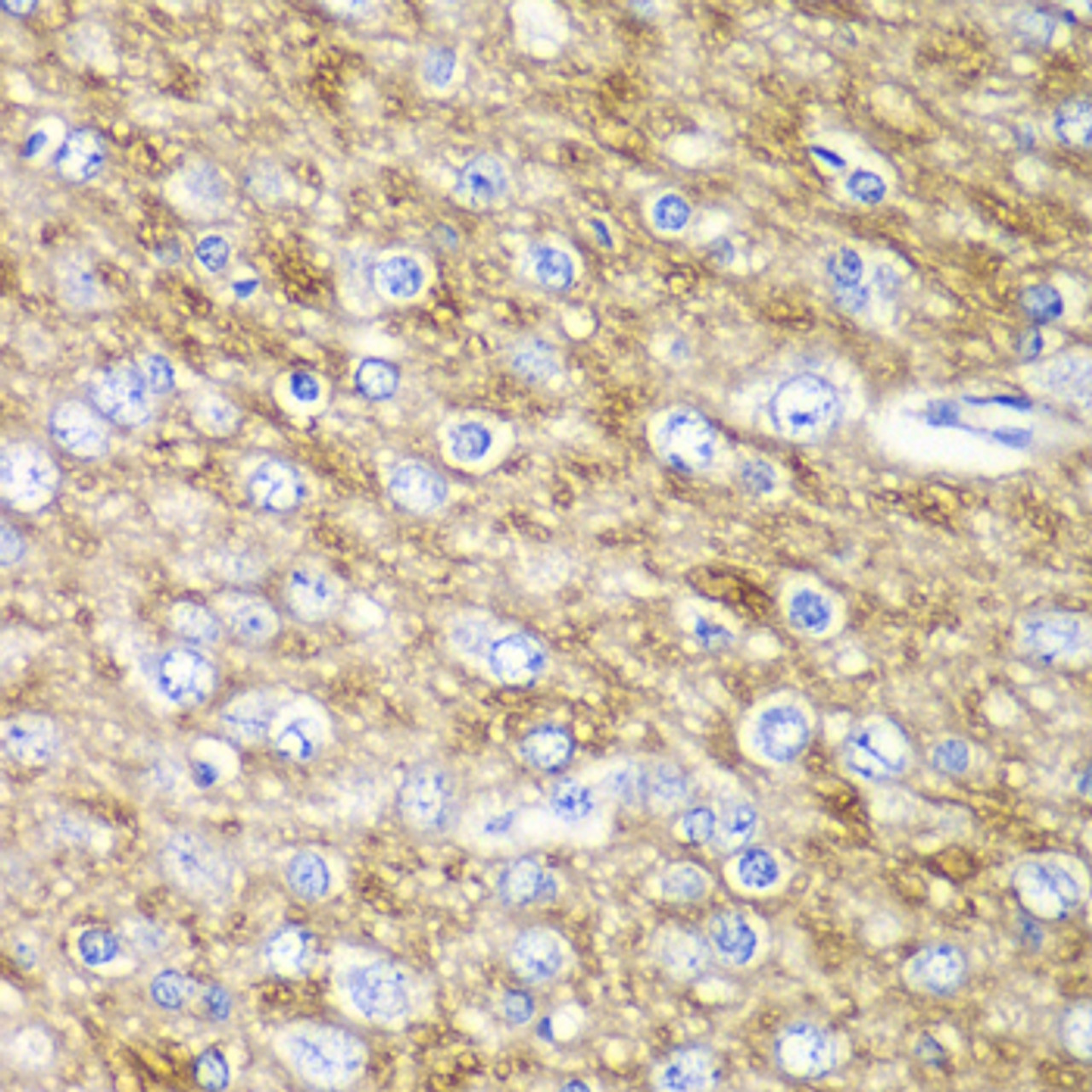 Immunohistochemistry of paraffin-embedded rat brain using ARFGAP1 antibody (14-531) at dilution of 1:100 (40x lens) .