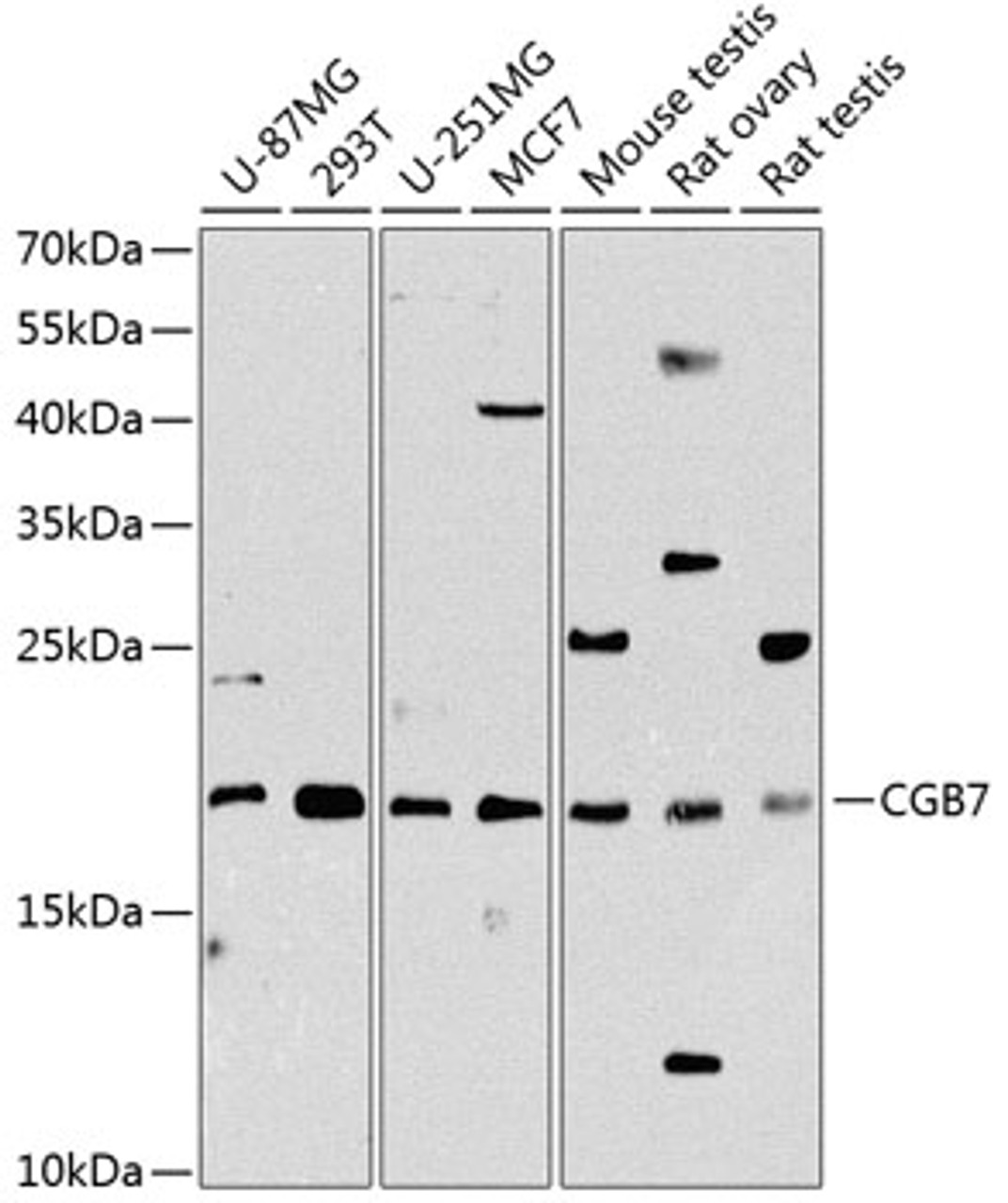 Western blot analysis of extracts of various cell lines, using CGB7 Antibody (14-536) at 1:1000 dilution.<br/>Secondary antibody: HRP Goat Anti-Rabbit IgG (H+L) at 1:10000 dilution.<br/>Lysates/proteins: 25ug per lane.<br/>Blocking buffer: 3% nonfat dry milk in TBST.<br/>Detection: ECL Basic Kit.<br/>Exposure time: 90s.