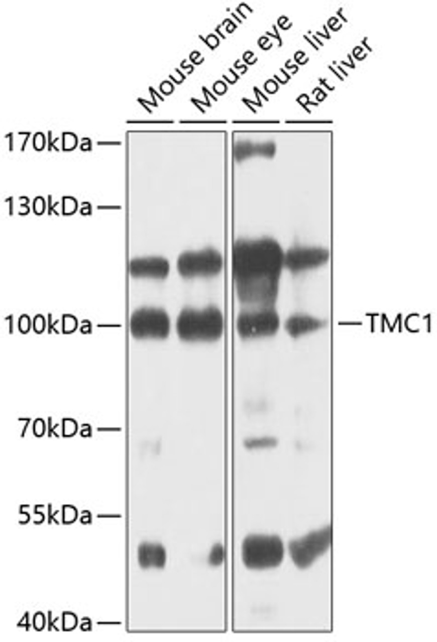 Western blot analysis of extracts of various cell lines, using TMC1 antibody (14-539) at 1:1000 dilution.<br/>Secondary antibody: HRP Goat Anti-Rabbit IgG (H+L) at 1:10000 dilution.<br/>Lysates/proteins: 25ug per lane.<br/>Blocking buffer: 3% nonfat dry milk in TBST.<br/>Detection: ECL Enhanced Kit.<br/>Exposure time: 60s.