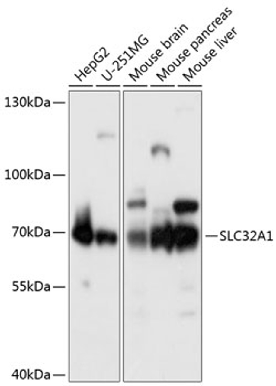 Western blot analysis of extracts of various cell lines, using SLC32A1 antibody (14-540) at 1:1000 dilution.<br/>Secondary antibody: HRP Goat Anti-Rabbit IgG (H+L) at 1:10000 dilution.<br/>Lysates/proteins: 25ug per lane.<br/>Blocking buffer: 3% nonfat dry milk in TBST.<br/>Detection: ECL Basic Kit.<br/>Exposure time: 10s.