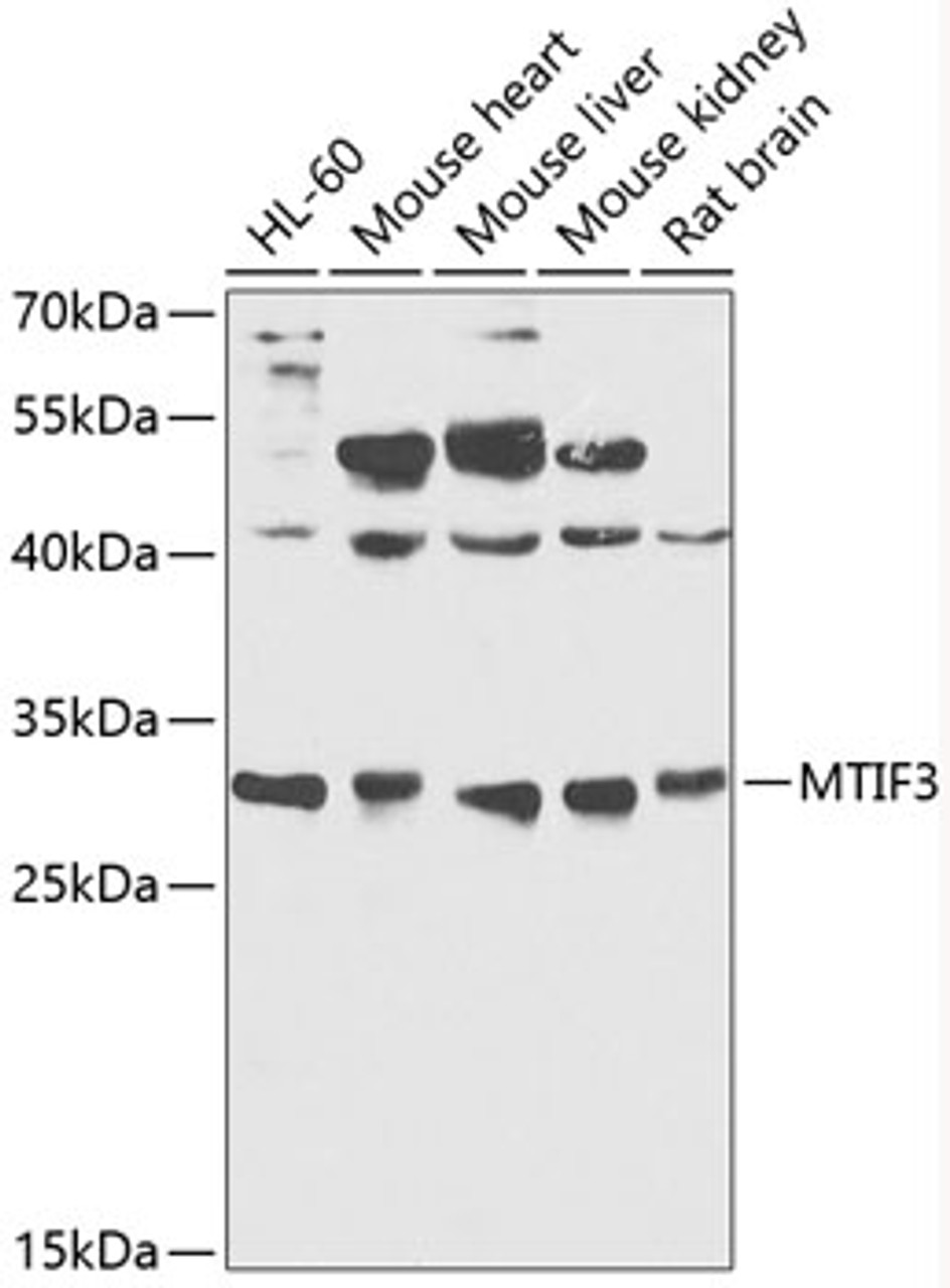 Western blot analysis of extracts of various cell lines, using MTIF3 antibody (14-542) at 1:1000 dilution.<br/>Secondary antibody: HRP Goat Anti-Rabbit IgG (H+L) at 1:10000 dilution.<br/>Lysates/proteins: 25ug per lane.<br/>Blocking buffer: 3% nonfat dry milk in TBST.<br/>Detection: ECL Basic Kit.<br/>Exposure time: 30s.