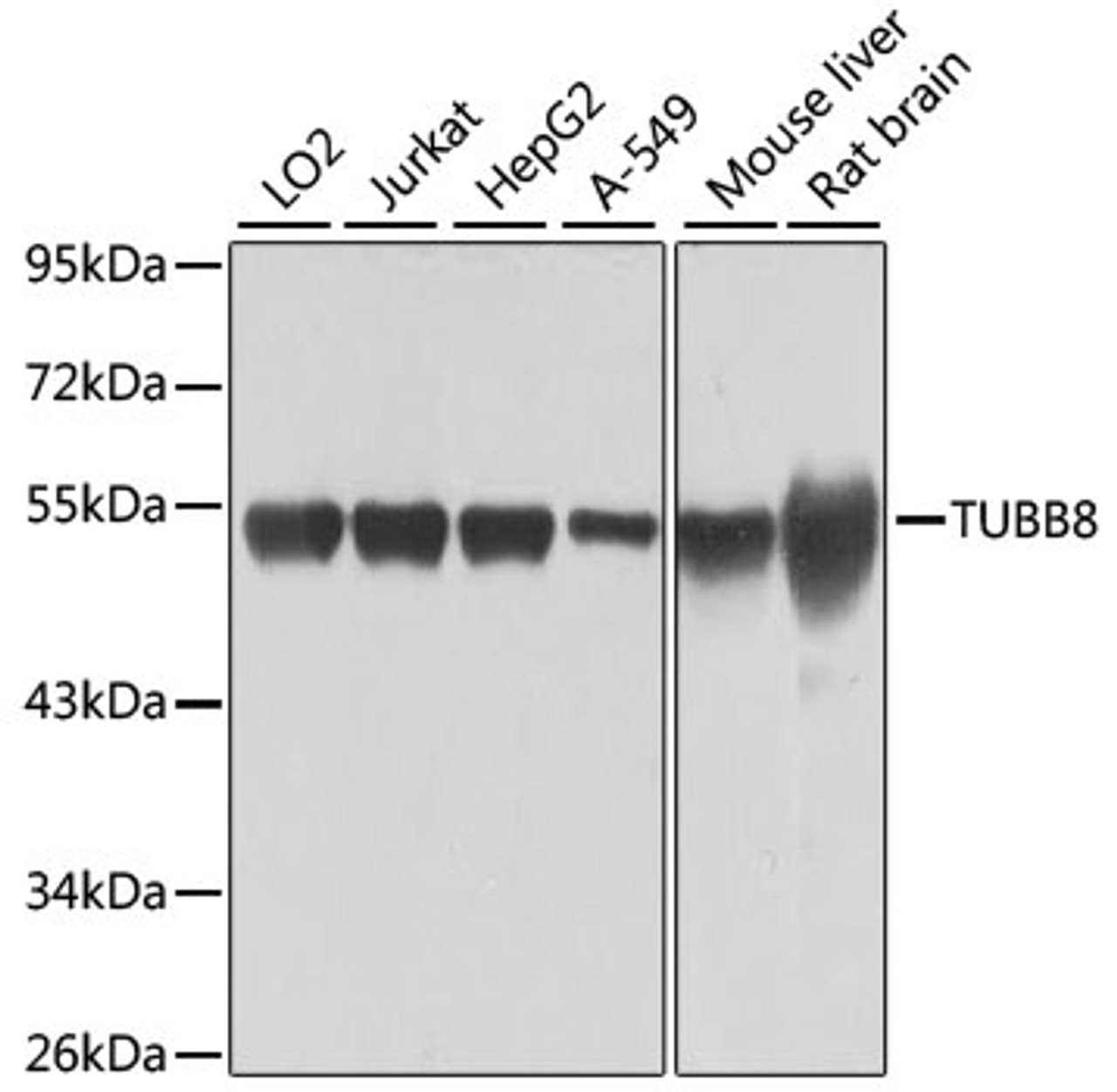 Western blot analysis of extracts of various cell lines, using TUBB8 antibody (14-544) at 1:1000 dilution.<br/>Secondary antibody: HRP Goat Anti-Rabbit IgG (H+L) at 1:10000 dilution.<br/>Lysates/proteins: 25ug per lane.<br/>Blocking buffer: 3% nonfat dry milk in TBST.<br/>Detection: ECL Basic Kit.<br/>Exposure time: 1s.