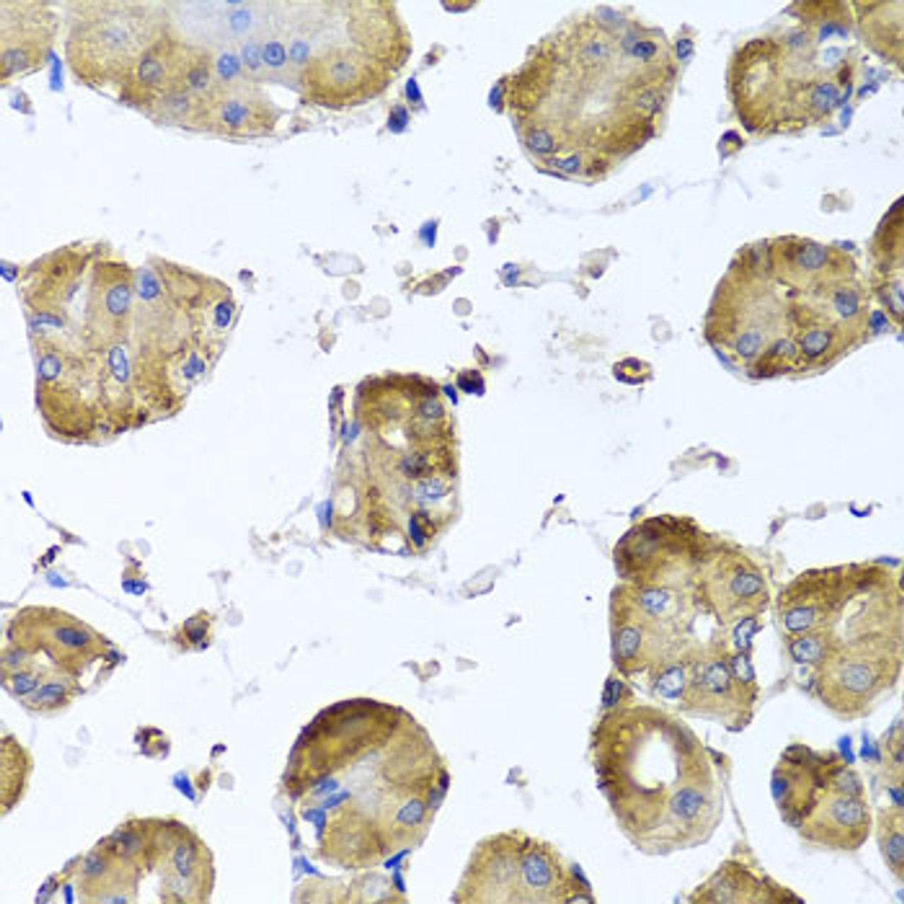 Immunohistochemistry of paraffin-embedded human stomach using TUBB8 antibody (14-544) at dilution of 1:100 (40x lens) .