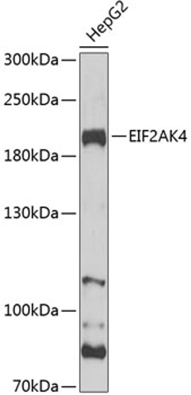 Western blot analysis of extracts of HepG2 cells, using EIF2AK4 Antibody (14-545) at 1:1000 dilution.<br/>Secondary antibody: HRP Goat Anti-Rabbit IgG (H+L) at 1:10000 dilution.<br/>Lysates/proteins: 25ug per lane.<br/>Blocking buffer: 3% nonfat dry milk in TBST.<br/>Detection: ECL Basic Kit.<br/>Exposure time: 30s.