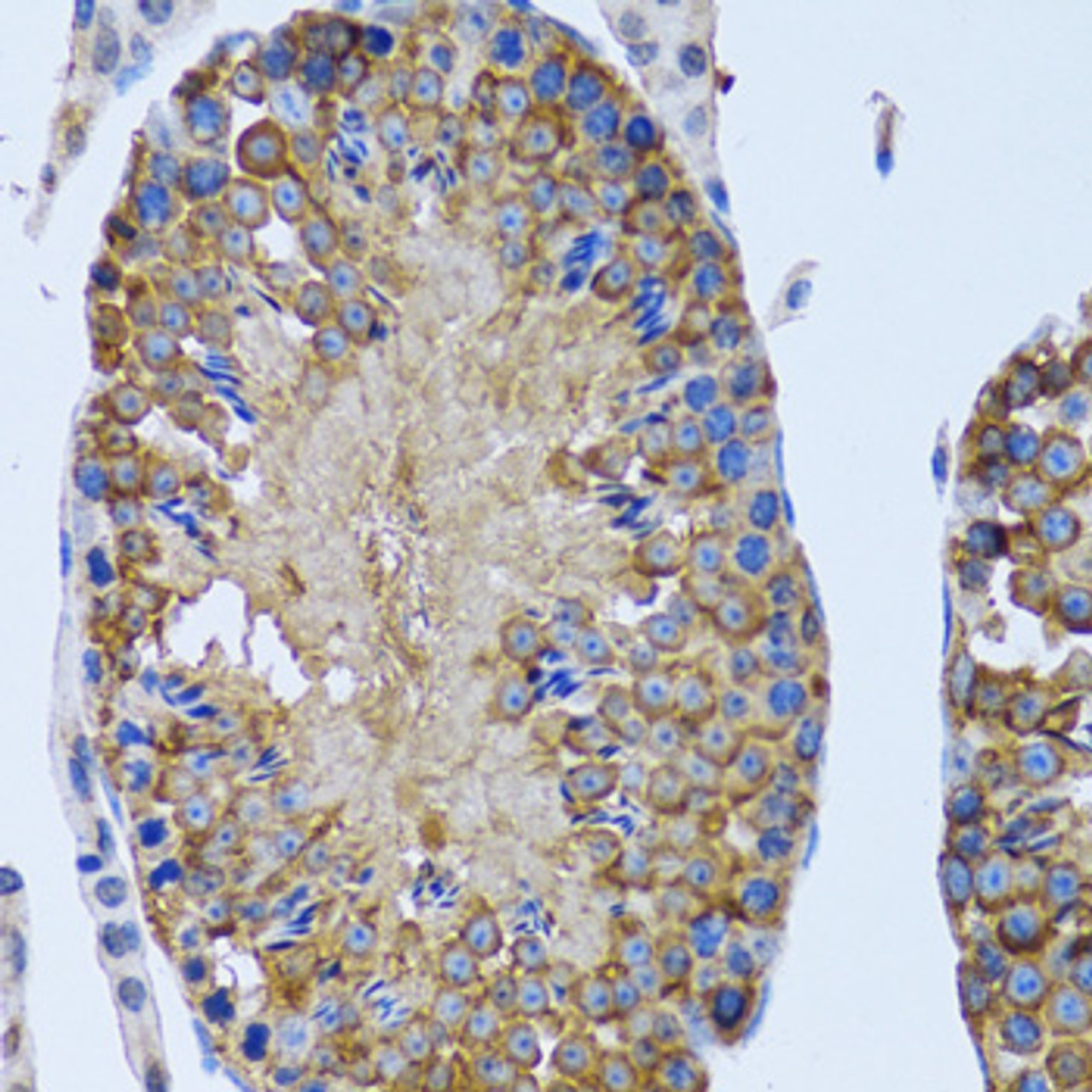 Immunohistochemistry of paraffin-embedded rat testis using EIF2AK4 antibody (14-545) at dilution of 1:100 (40x lens) .