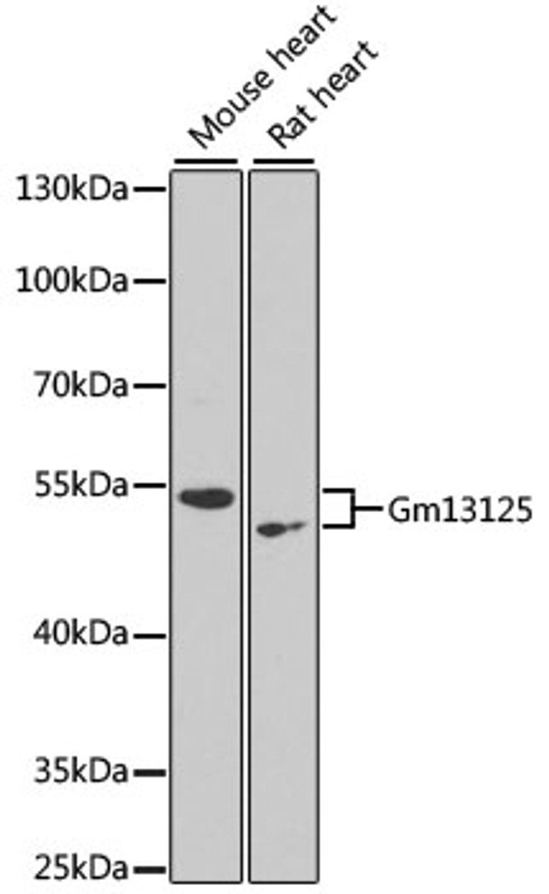 Western blot analysis of extracts of various cell lines, using Gm13125 antibody (14-546) at 1:1000 dilution.<br/>Secondary antibody: HRP Goat Anti-Rabbit IgG (H+L) at 1:10000 dilution.<br/>Lysates/proteins: 25ug per lane.<br/>Blocking buffer: 3% nonfat dry milk in TBST.<br/>Detection: ECL Enhanced Kit.<br/>Exposure time: 90s.