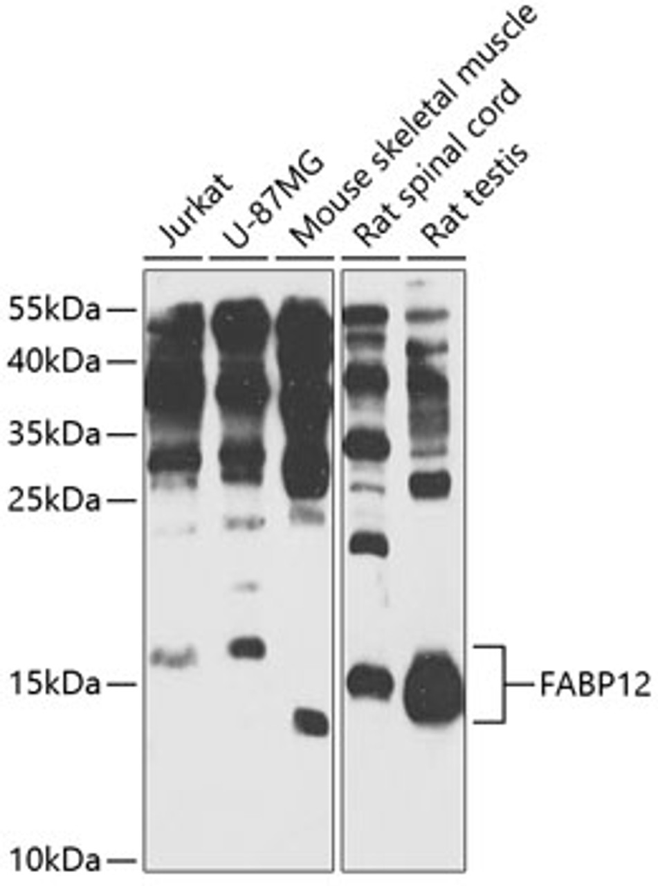 Western blot analysis of extracts of various cell lines, using FABP12 antibody (14-547) at 1:1000 dilution.<br/>Secondary antibody: HRP Goat Anti-Rabbit IgG (H+L) at 1:10000 dilution.<br/>Lysates/proteins: 25ug per lane.<br/>Blocking buffer: 3% nonfat dry milk in TBST.<br/>Detection: ECL Basic Kit.<br/>Exposure time: 60s.