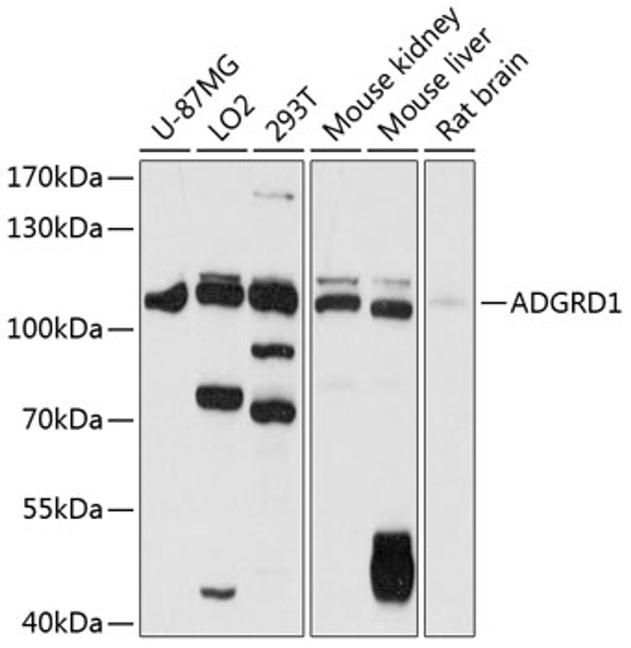 Western blot analysis of extracts of various cell lines, using ADGRD1 antibody (14-550) at 1:1000 dilution.<br/>Secondary antibody: HRP Goat Anti-Rabbit IgG (H+L) at 1:10000 dilution.<br/>Lysates/proteins: 25ug per lane.<br/>Blocking buffer: 3% nonfat dry milk in TBST.<br/>Detection: ECL Basic Kit.<br/>Exposure time: 5s.