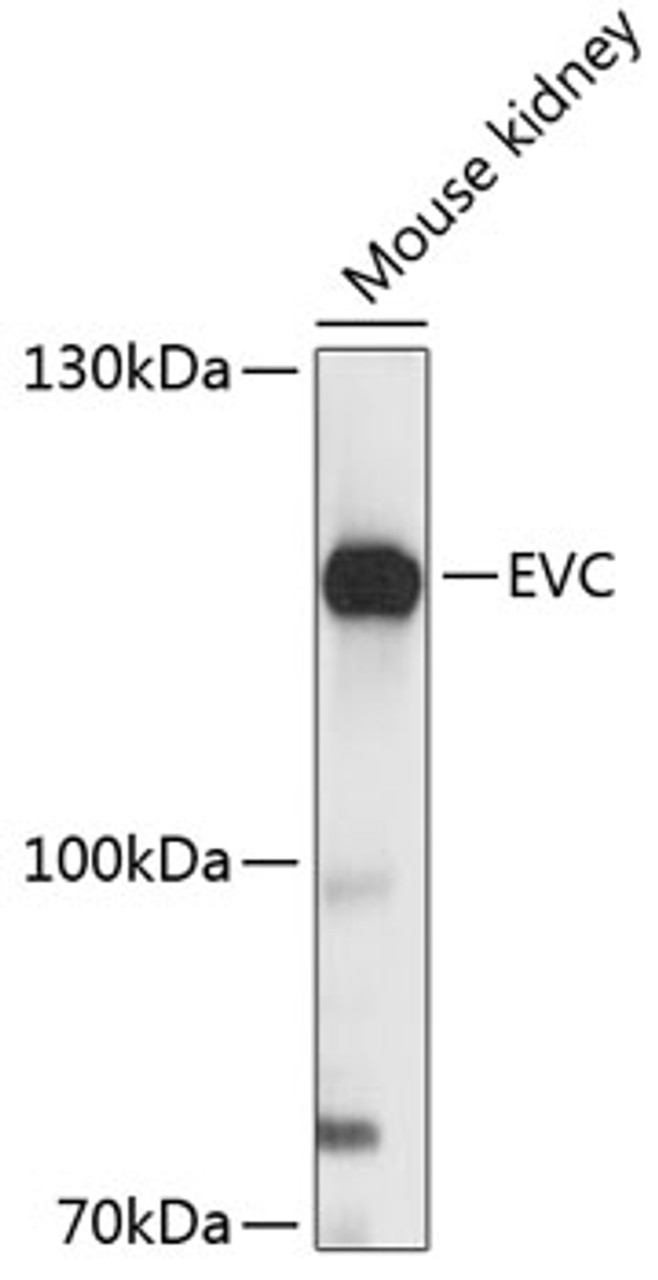 Western blot analysis of extracts of mouse kidney, using EVC antibody (14-553) at 1:3000 dilution.<br/>Secondary antibody: HRP Goat Anti-Rabbit IgG (H+L) at 1:10000 dilution.<br/>Lysates/proteins: 25ug per lane.<br/>Blocking buffer: 3% nonfat dry milk in TBST.<br/>Detection: ECL Basic Kit.<br/>Exposure time: 10s.