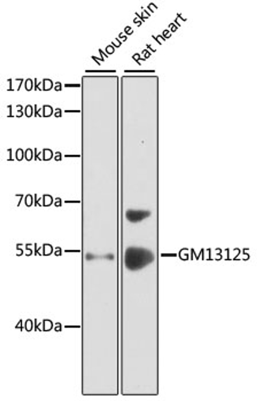 Western blot analysis of extracts of various cell lines, using GM13125 antibody (14-554) at 1:1000 dilution.<br/>Secondary antibody: HRP Goat Anti-Rabbit IgG (H+L) at 1:10000 dilution.<br/>Lysates/proteins: 25ug per lane.<br/>Blocking buffer: 3% nonfat dry milk in TBST.<br/>Detection: ECL Enhanced Kit.<br/>Exposure time: 30s.