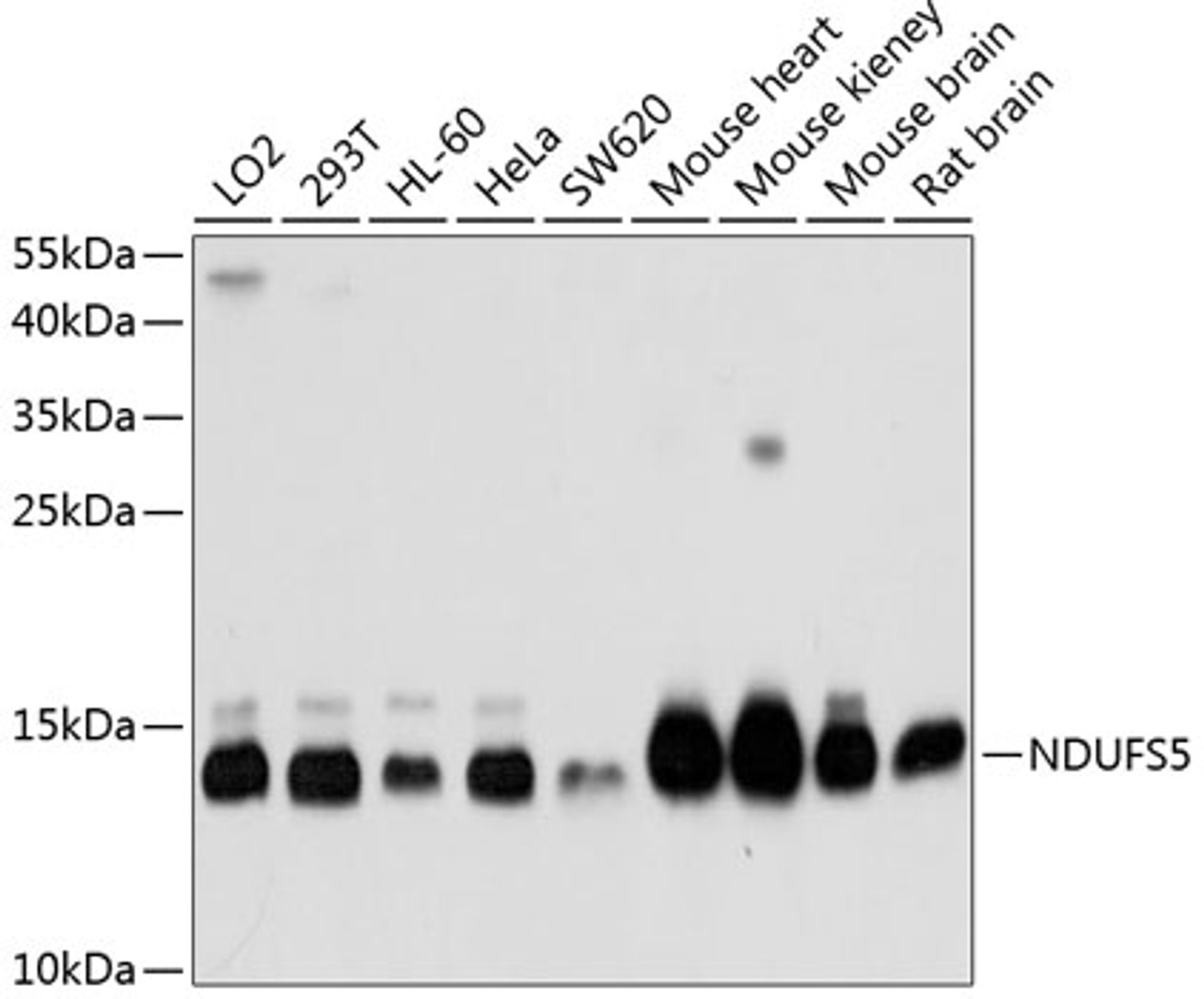 Western blot analysis of extracts of various cell lines, using NDUFS5 antibody (14-561) at 1:1000 dilution.<br/>Secondary antibody: HRP Goat Anti-Rabbit IgG (H+L) at 1:10000 dilution.<br/>Lysates/proteins: 25ug per lane.<br/>Blocking buffer: 3% nonfat dry milk in TBST.<br/>Detection: ECL Basic Kit.<br/>Exposure time: 1s.