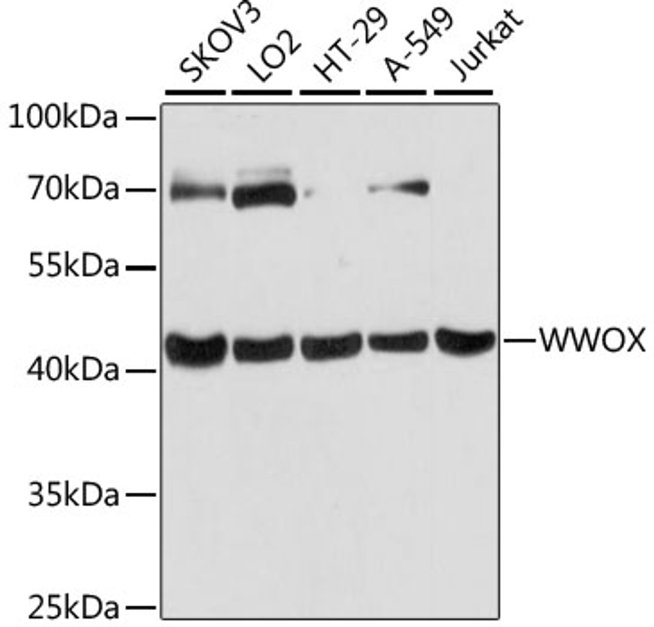 Western blot analysis of extracts of various cell lines, using WWOX antibody (14-562) at 1:3000 dilution.<br/>Secondary antibody: HRP Goat Anti-Rabbit IgG (H+L) at 1:10000 dilution.<br/>Lysates/proteins: 25ug per lane.<br/>Blocking buffer: 3% nonfat dry milk in TBST.<br/>Detection: ECL Basic Kit.<br/>Exposure time: 10s.