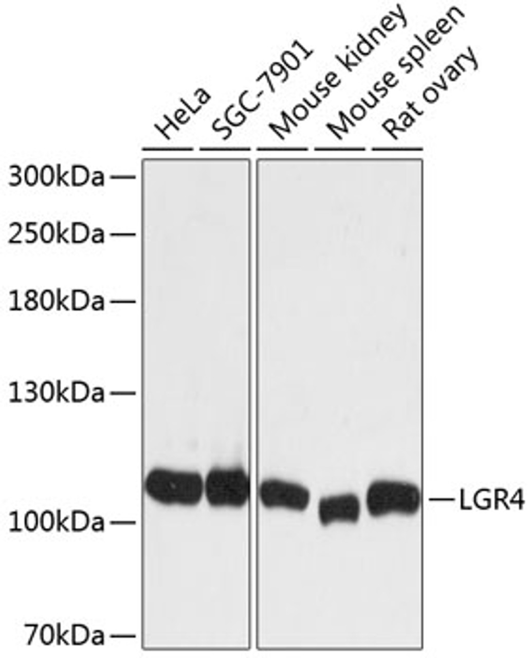 Western blot analysis of extracts of various cell lines, using LGR4 antibody (14-566) at 1:3000 dilution.<br/>Secondary antibody: HRP Goat Anti-Rabbit IgG (H+L) at 1:10000 dilution.<br/>Lysates/proteins: 25ug per lane.<br/>Blocking buffer: 3% nonfat dry milk in TBST.<br/>Detection: ECL Basic Kit.<br/>Exposure time: 1s.