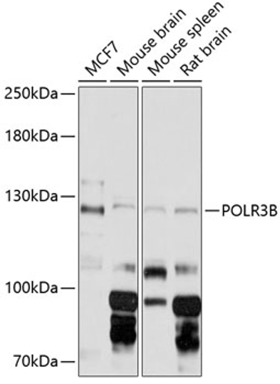 Western blot analysis of extracts of various cell lines, using POLR3B Antibody (14-569) at 1:3000 dilution.<br/>Secondary antibody: HRP Goat Anti-Rabbit IgG (H+L) at 1:10000 dilution.<br/>Lysates/proteins: 25ug per lane.<br/>Blocking buffer: 3% nonfat dry milk in TBST.<br/>Detection: ECL Basic Kit.<br/>Exposure time: 5s.