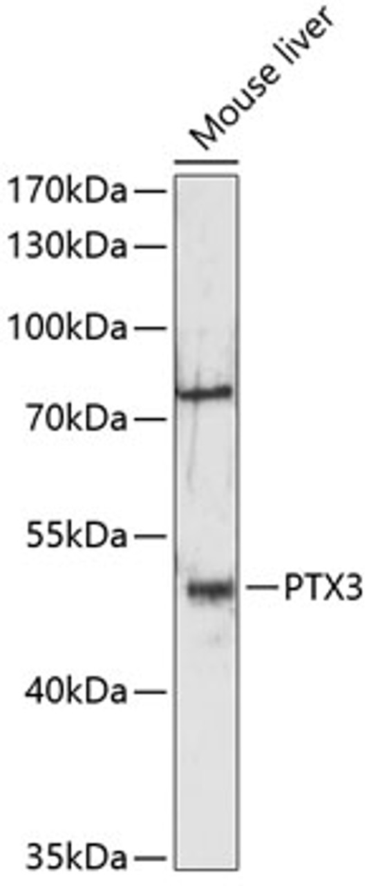 Western blot analysis of extracts of mouse liver, using PTX3 antibody (14-573) at 1:3000 dilution.<br/>Secondary antibody: HRP Goat Anti-Rabbit IgG (H+L) at 1:10000 dilution.<br/>Lysates/proteins: 25ug per lane.<br/>Blocking buffer: 3% nonfat dry milk in TBST.<br/>Detection: ECL Enhanced Kit.<br/>Exposure time: 90s.