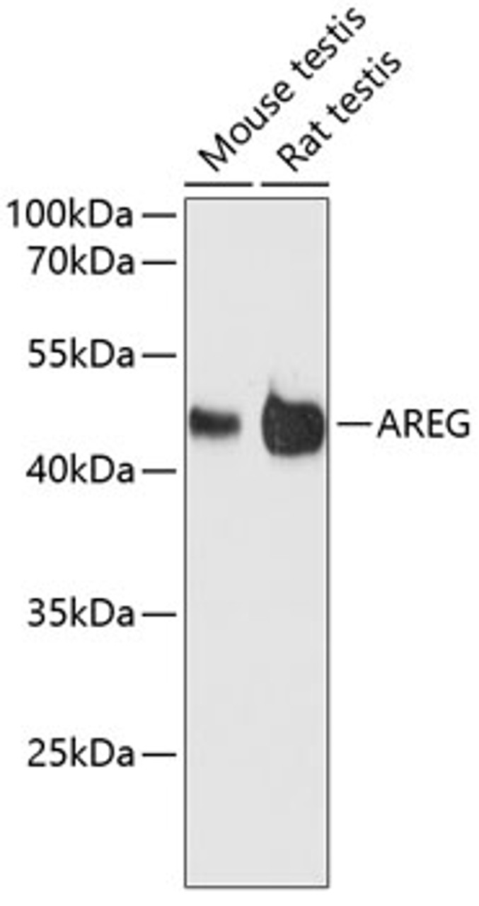 Western blot analysis of extracts of various cell lines, using AREG antibody (14-577) at 1:3000 dilution.<br/>Secondary antibody: HRP Goat Anti-Rabbit IgG (H+L) at 1:10000 dilution.<br/>Lysates/proteins: 25ug per lane.<br/>Blocking buffer: 3% nonfat dry milk in TBST.<br/>Detection: ECL Basic Kit.<br/>Exposure time: 90s.