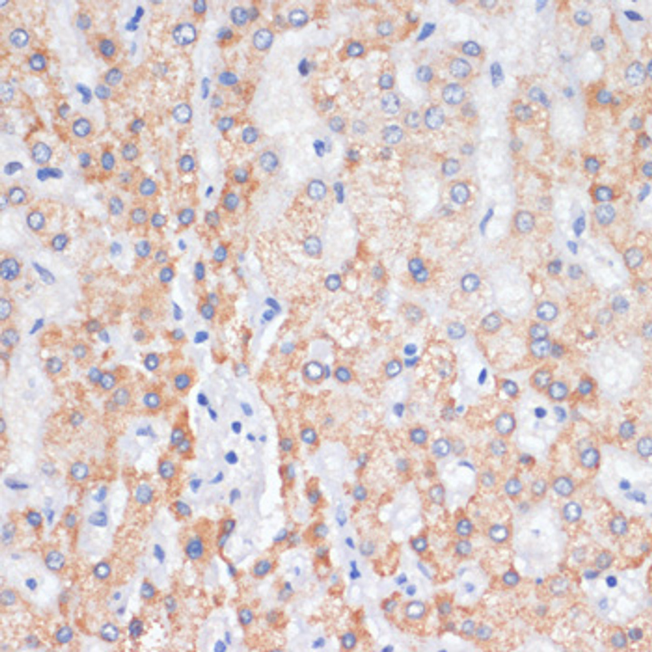 Immunohistochemistry of paraffin-embedded human liver using AREG antibody (14-577) at dilution of 1:100 (40x lens) .