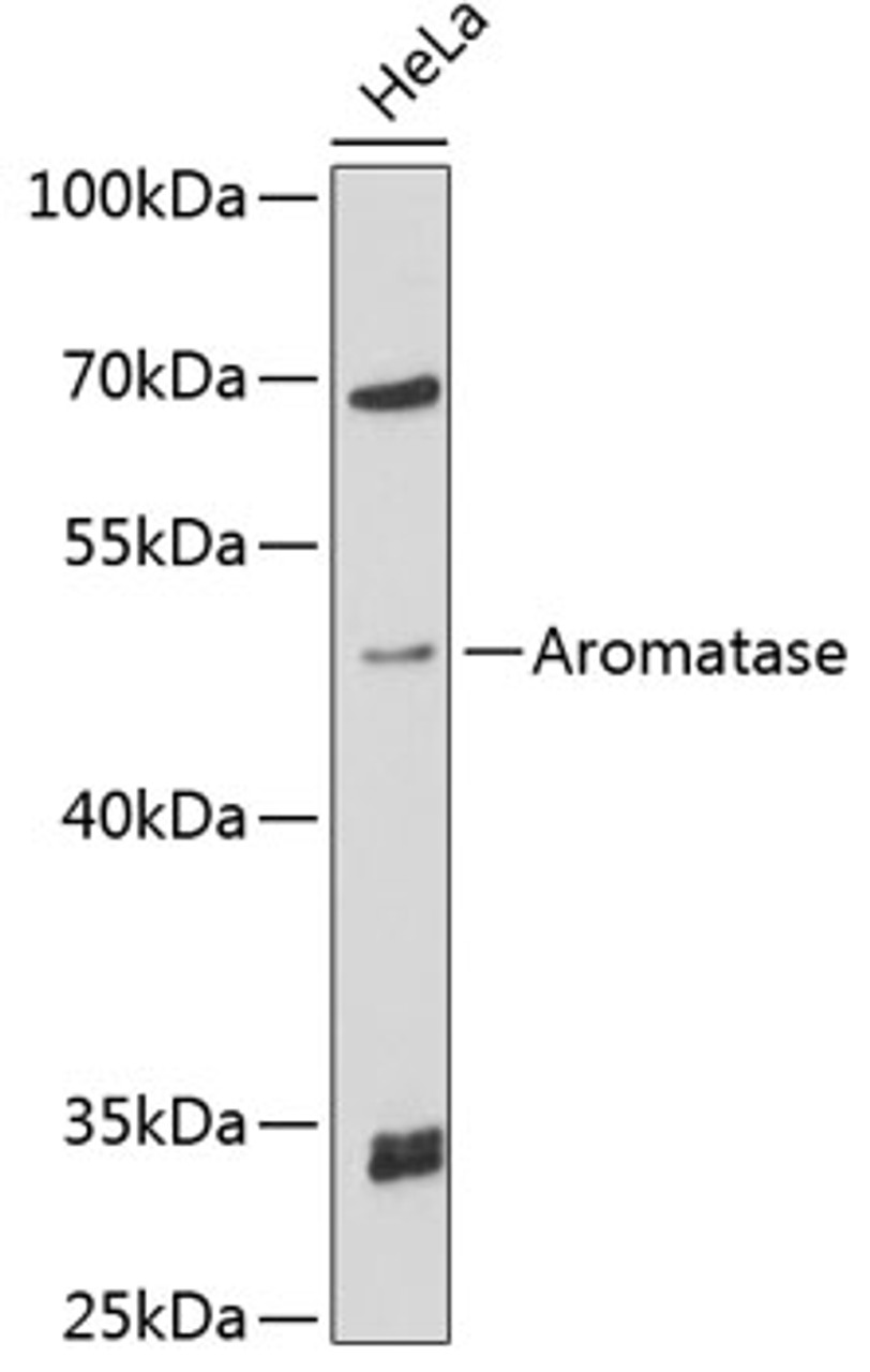 Western blot analysis of extracts of HeLa cells, using Aromatase antibody (14-578) at 1:3000 dilution.<br/>Secondary antibody: HRP Goat Anti-Rabbit IgG (H+L) at 1:10000 dilution.<br/>Lysates/proteins: 25ug per lane.<br/>Blocking buffer: 3% nonfat dry milk in TBST.<br/>Detection: ECL Basic Kit.<br/>Exposure time: 60s.