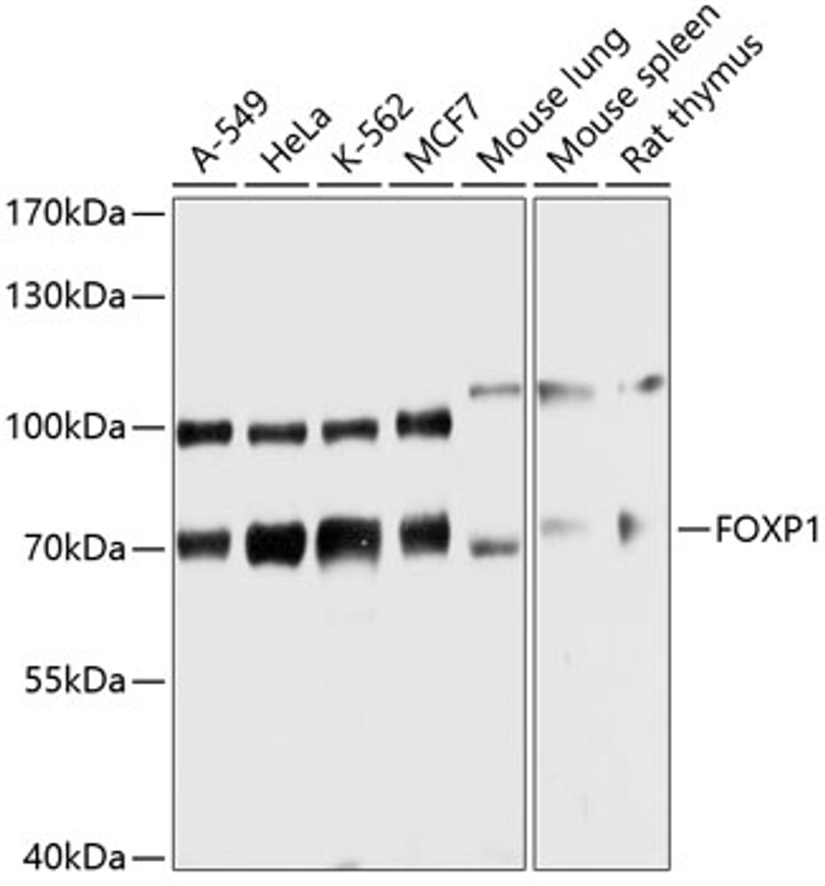 Western blot analysis of extracts of various cell lines, using FOXP1 antibody (14-579) at 1:3000 dilution.<br/>Secondary antibody: HRP Goat Anti-Rabbit IgG (H+L) at 1:10000 dilution.<br/>Lysates/proteins: 25ug per lane.<br/>Blocking buffer: 3% nonfat dry milk in TBST.<br/>Detection: ECL Basic Kit.<br/>Exposure time: 30s.
