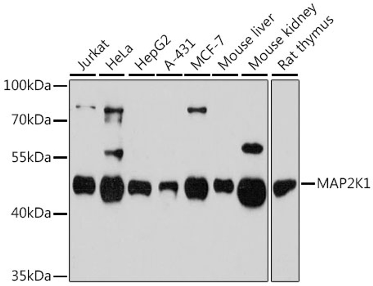 Western blot analysis of extracts of various cell lines, using MAP2K1 antibody (14-580) at 1:3000 dilution.<br/>Secondary antibody: HRP Goat Anti-Rabbit IgG (H+L) at 1:10000 dilution.<br/>Lysates/proteins: 25ug per lane.<br/>Blocking buffer: 3% nonfat dry milk in TBST.<br/>Detection: ECL Enhanced Kit.<br/>Exposure time: 90s.