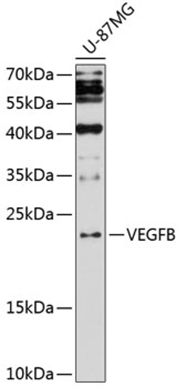 Western blot analysis of extracts of U-87MG cells, using VEGFB antibody (14-581) at 1:3000 dilution._Secondary antibody: HRP Goat Anti-Rabbit IgG (H+L) at 1:10000 dilution._Lysates/proteins: 25ug per lane._Blocking buffer: 3% nonfat dry milk in TBST._Detection: ECL Enhanced Kit._Exposure time: 90s.