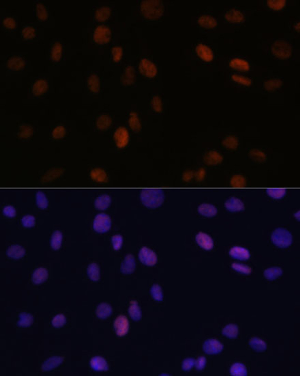 Immunofluorescence analysis of C6 cells using PSME3 Polyclonal Antibody (14-585) at dilution of 1:100 (40x lens) . Blue: DAPI for nuclear staining.